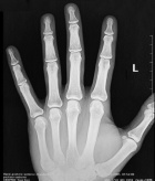 Zoom image: Radiological image