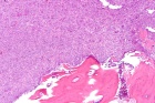 Zoom image: Cell stain