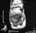 Zoom image: Radiological image