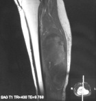 Zoom image: Radiological image