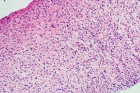 Zoom image: Cell stain