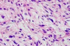 Zoom image: Cell stain