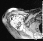 Zoom image: Radiological image