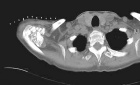 Zoom image: Radiological image