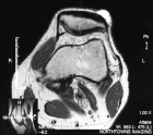 Zoom image: Radiological image
