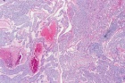 Zoom image: Cell stain