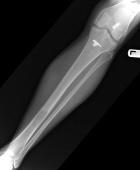 Zoom image: Radiological image