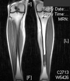 Zoom image: Radiological image