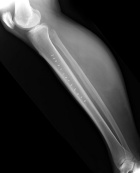 Zoom image: Radiological image