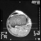 Zoom image: Radiological image