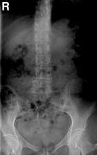 Zoom image: Radiological image