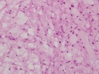 Zoom image: Cell stain