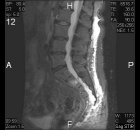Zoom image: Radiological image