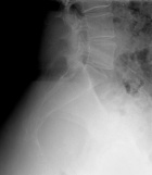 Zoom image: Radiological image