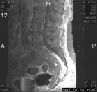 Zoom image: Radiological image