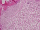 Zoom image: Cell stain