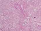 Zoom image: Cell stain