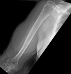 Zoom image: Radiological image