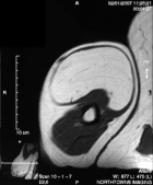 Zoom image: Radiological image