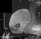 Zoom image: Radiological image
