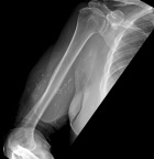 Zoom image: Radiological image