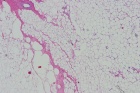 Zoom image: Cell stain