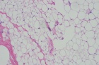 Zoom image: Cell stain