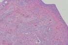 Zoom image: Cell stain