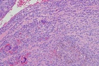 Zoom image: Cell stain