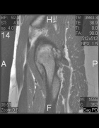 Zoom image: Radiological image