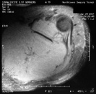 Zoom image: Radiological image