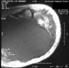 Zoom image: Radiological image