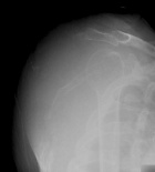 Zoom image: Radiological image