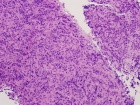 Zoom image: Cell stain