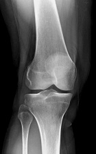 Zoom image: Radiological image