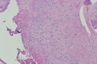 Zoom image: Cell stain