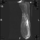 Zoom image: Radiological image
