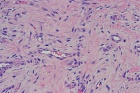 Zoom image: Cell stain