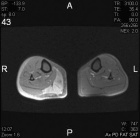 Zoom image: Radiological image