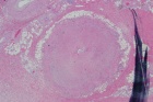 Zoom image: Cell stain