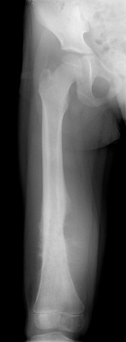 Zoom image: Radiological image