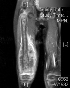 Zoom image: Radiological image