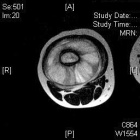 Zoom image: Radiological image