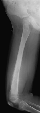 Zoom image: Radiological image