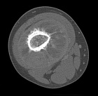 Zoom image: Radiological image