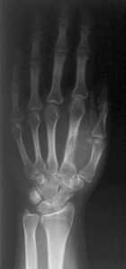 Zoom image: Radiological image