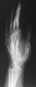 Zoom image: Radiological image