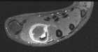 Zoom image: Radiological image