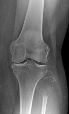 Zoom image: Radiological image