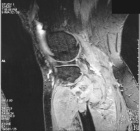 Zoom image: Radiological image